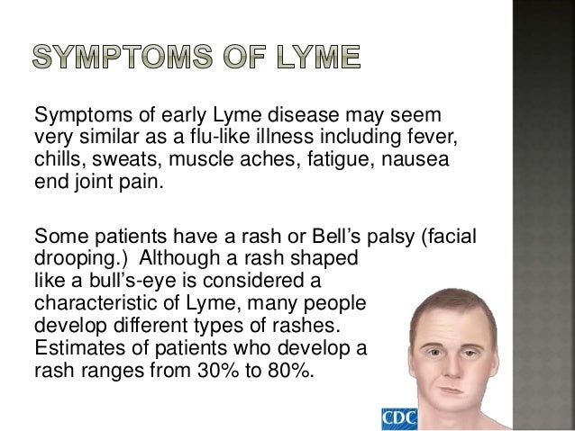 facial pain fever lyme disease Facial pain fever lyme disease